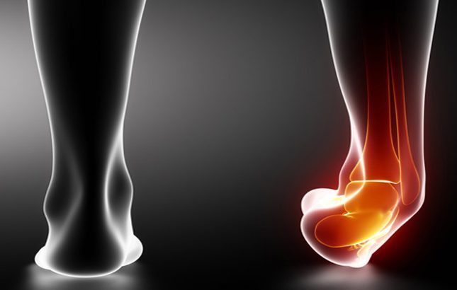 Διάστρεμμα Ποδοκνημικής.